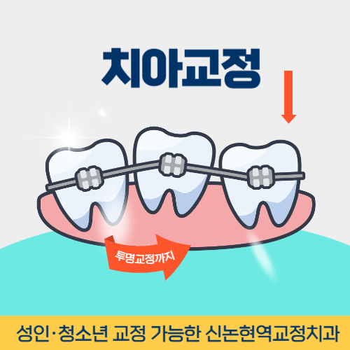 부천치과 부천역치과 치아교정