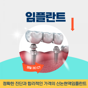 부천치과 부천역치과 임플란트