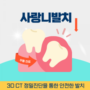부천치과 부천역치과 사랑니 발치