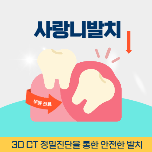 부천치과 부천역치과 사랑니 발치
