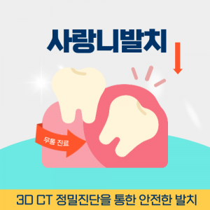 부천치과 사랑니발치