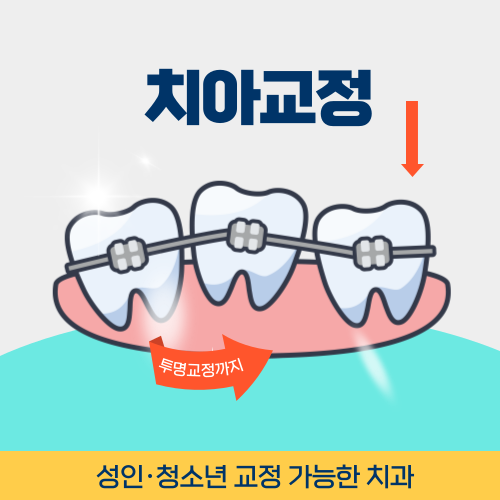 부천치과 치아교정