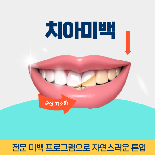 부천치과 치아미백