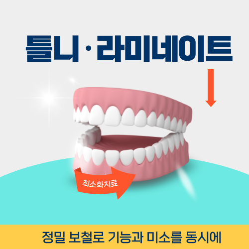 부천치과 틀니 라미네이트